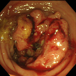 1おしりから出血している、膿(うみ)が出ている