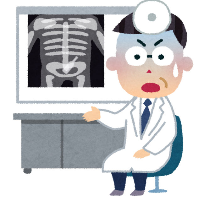 大事件に発展することも!おしりの異物の原因でうそをついてはいけない理由。