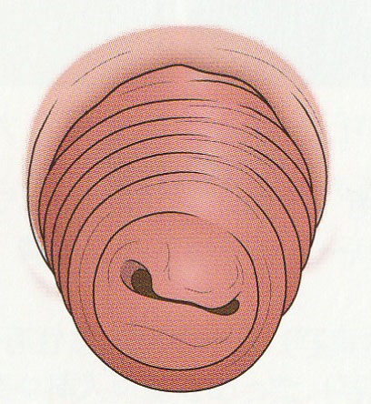 おしりから腸が出てきてしまう。実は意外な原因が…