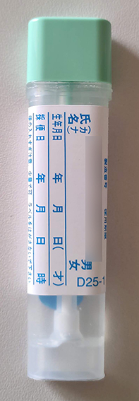 便潜血検査ってどういう検査?