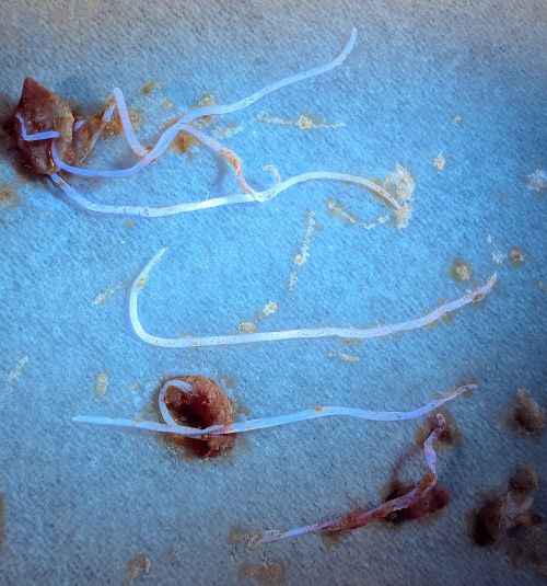 アニサキス中毒の原因はアレルギー、死骸がアレルギーの原因になることも