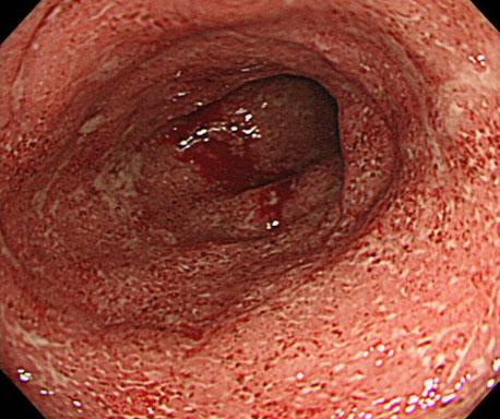 どうやって診断する?